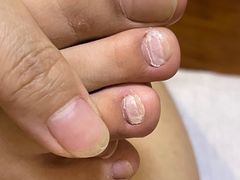 -世龙世家甲沟炎·灰指甲·嵌甲矫正·修脚(武侯区双楠店)