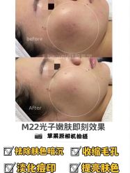-E.beauty驻颜·痘敏肌调理中心