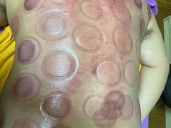 -沈师傅盲人按摩工作室(密三小区店)