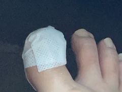 -祖传修脚甲沟炎灰指甲鸡眼