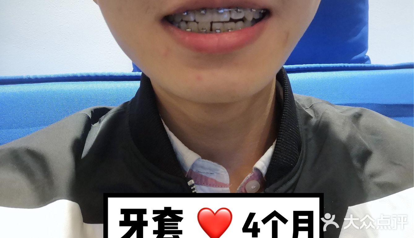 【案例分享】今天我们来讲个小帅哥的正畸案例
