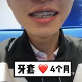 【案例分享】今天我们来讲个小帅哥的正畸案例