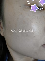 体验前-深圳美莱医疗美容医院