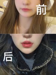 -Yestar宁波艺星整形医院