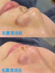 -LUNA皮相美·骨相美高级美感