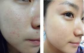 -SKINIST丽铂医疗美容