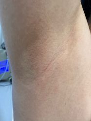 点击看大图 -深圳美莱医疗美容医院