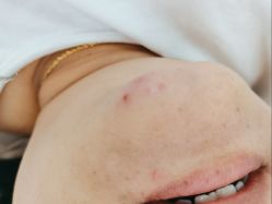 -蕾特恩专业祛痘·皮肤管理