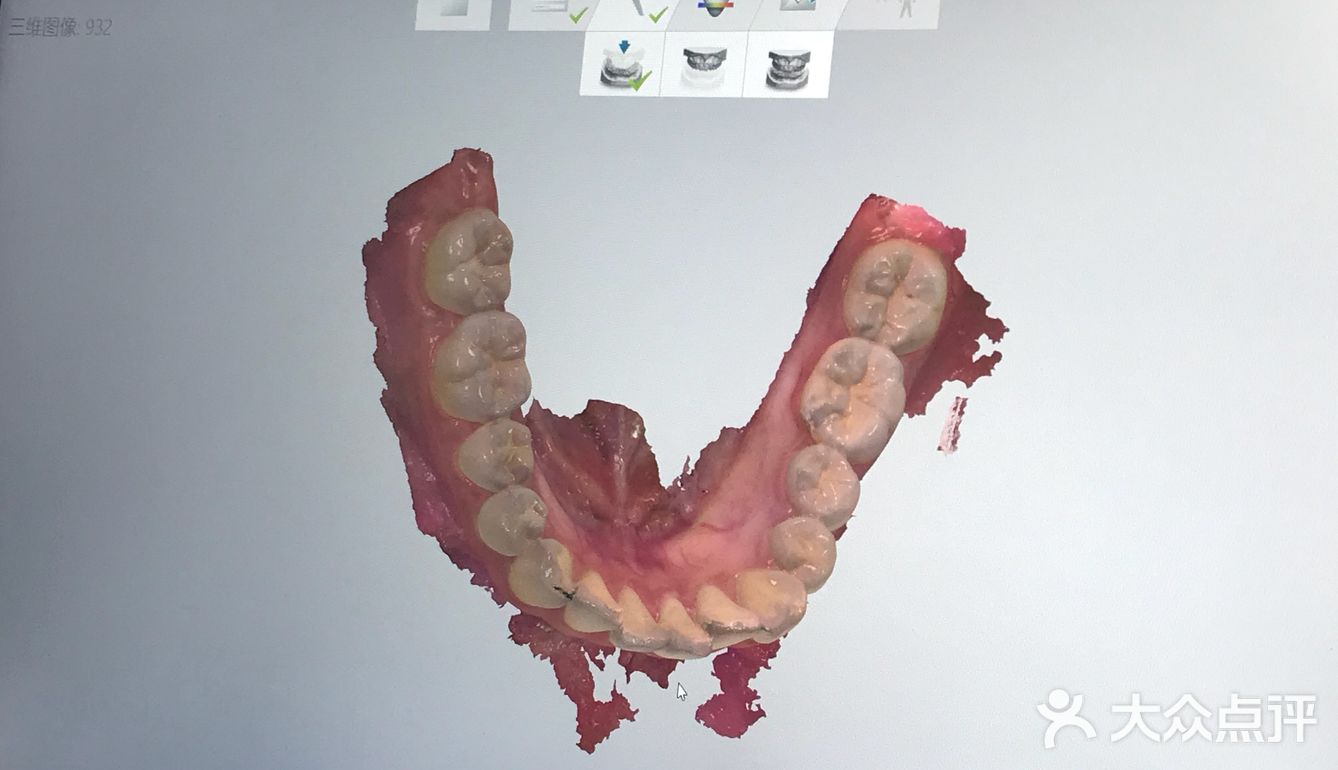 你确定你不想矫牙？