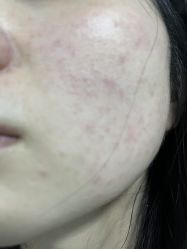 体验后-深圳美莱医疗美容医院
