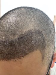 -熙朵美学植发·连锁品牌