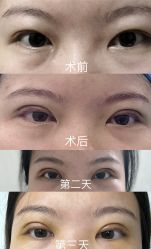 -广州美莱医疗美容医院