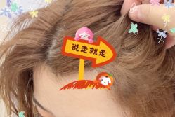 -大麦微针植发全国连锁