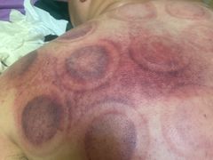 -沈师傅盲人按摩工作室(密三小区店)