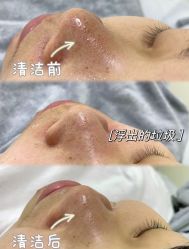 -美愈美肤MEIYU SKIN