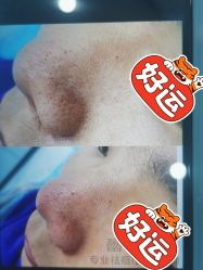 点击看大图 -蕾特恩专业祛痘·皮肤管理