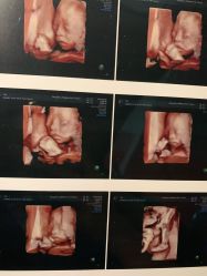 点击看大图 -杭州贝瑞斯美华妇儿医院·早孕·产检·儿科