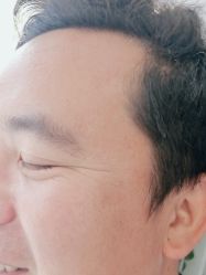 点击看大图 -海涛医疗美容·面部抗衰·注射美鼻