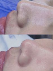 -美肤盾祛痘·问题肌头疗管理中心