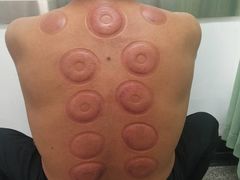 -孟氏拔罐(纬一路店)