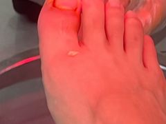 -世龙世家甲沟炎·灰指甲·嵌甲矫正·修脚(武侯区双楠店)