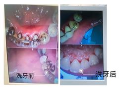 -牙博士口腔(杨浦店)