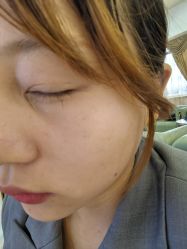 -长沙雅美医疗美容医院