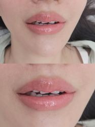 点击看大图 -西施无菌半永久纹绣眉眼影唇轻增发纹发际线