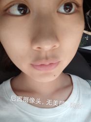 体验后-坤如玛丽·医疗美容中心
