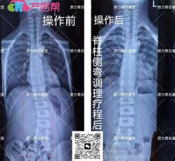 点击看大图 -产后帮产后修复(首城国际店)