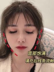 -Yestar宁波艺星整形医院
