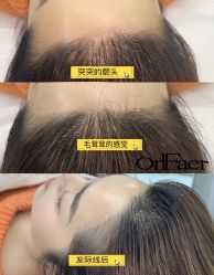 -OnFaer.纹眉半永久无创洗眉