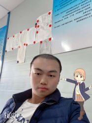 -大麦微针植发丨全国连锁