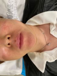 -海涛医疗美容·面部抗衰·注射美鼻