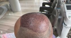 -雍禾植发全国连锁