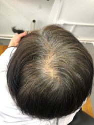 -髻尚坊增发补发织发假发定制