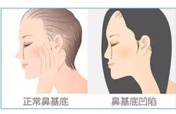 -深圳春天阳光医院·轮廓抗衰中心