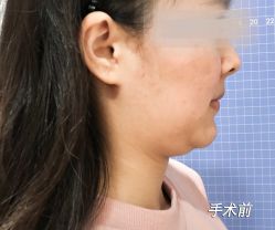 体验前-南京康美美容医院·旗舰店