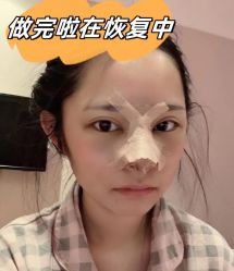 -素美医疗美容·西南眼鼻整形·修复基地