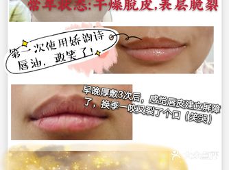 娇韵诗唇油野生代言人，不接受拒签！