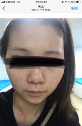 体验前-厦门美莱整形美容医院