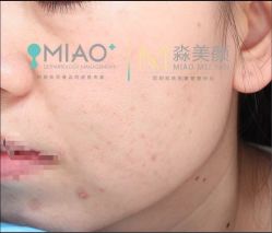 -韩国淼美颜皮肤管理官方直营店