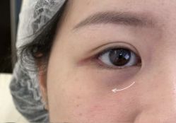 -杭州米兰柏羽医疗美容医院