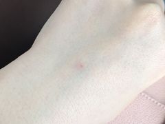 -上海中医药大学附属曙光医院(东部)