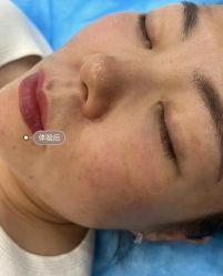 -天津健丽·去眼袋医疗美容机构