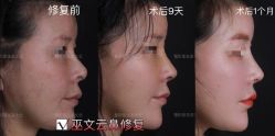 -北京米扬丽格医疗美容·联合丽格鼻整形中心
