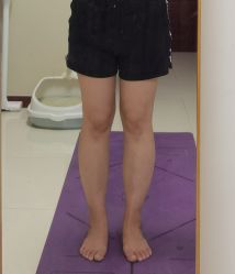 体验后-深圳美莱医疗美容医院