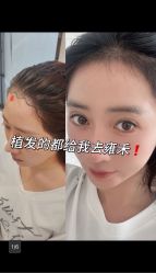 -雍禾植发全国连锁