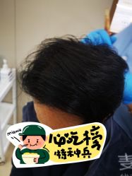 -大麦微针植发全国连锁