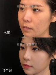 -北京米扬丽格医疗美容·联合丽格鼻整形中心